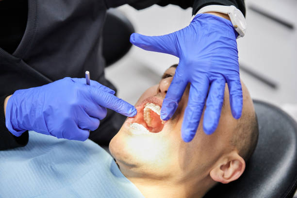 Best Urgent Care for Lost Fillings or Crowns in Morrisonvle, IL