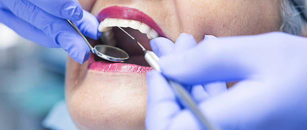 Best Emergency Denture Repair in Morrisonvle, IL